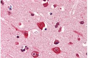 Human Brain, Cortex (formalin-fixed, paraffin-embedded) stained with PDPN antibody ABIN364350 at 5 ug/ml followed by biotinylated anti-mouse IgG secondary antibody ABIN481714, alkaline phosphatase-streptavidin and chromogen. (Podoplanin Antikörper  (AA 1-206))