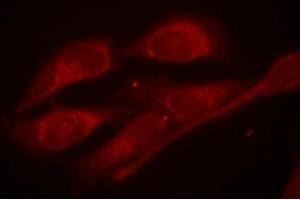 Immunofluorescence staining of methanol-fixed Hela cells using Shc1(Phospho-Tyr427) Antibody. (SHC1 Antikörper  (pTyr427))