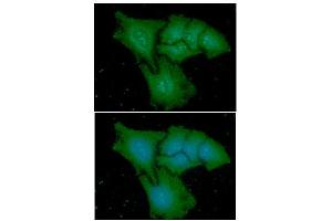 ICC/IF analysis of CAPG in HeLa cells line, stained with DAPI (Blue) for nucleus staining and monoclonal anti-human CAPG antibody (1:100) with goat anti-mouse IgG-Alexa fluor 488 conjugate (Green). (CAPG Antikörper  (AA 1-348))