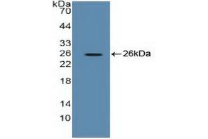 Western blot analysis of recombinant Human EEF2. (EEF2 Antikörper  (AA 32-233))