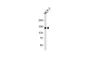 Lane 1: MCF-7 cell lysates, probed with DDR1 (1464CT339. (DDR1 Antikörper)