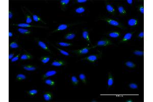 Immunofluorescence of monoclonal antibody to ARF1 on HeLa cell. (ARF1 Antikörper  (AA 1-181))