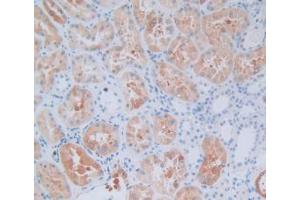IHC-P analysis of Human Kidney Tissue, with DAB staining. (CRYAB Antikörper  (AA 1-175))