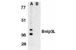 Western blot analysis of Bnip3L in K562 whole cell lysate in the absence (A), or presence (B) of immunogenic peptide with Bnip3L antibody at 1μg/ml. (BNIP3L/NIX Antikörper  (AA 77-92))