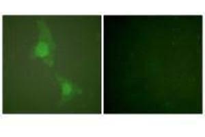 Immunofluorescence analysis of HeLa cells, using ADD1 (Ab-726) antibody (alpha Adducin Antikörper  (Ser726))