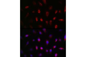 Immunofluorescence (IF) image for anti-Guanine Nucleotide Binding Protein (G Protein), beta Polypeptide 3 (GNB3) (AA 1-230) antibody (ABIN1680055)