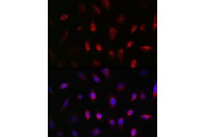 Immunofluorescence analysis of U-251MG cells using GNB3 Rabbit pAb (ABIN1680055, ABIN3015467, ABIN3015468 and ABIN6218020) at dilution of 1:50 (40x lens). (GNB3 Antikörper  (AA 1-230))