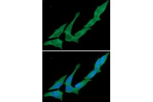 ICC/IF analysis of CD73 in HeLa cells. (CD73 Antikörper)