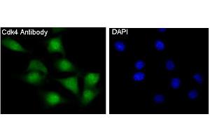 Immunofluorescent analysis of NIH/3T3 cells, using CDK4 Antibody. (Rekombinanter CDK4 Antikörper)