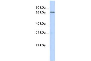 WB Suggested Anti-PCCA Antibody Titration:  0. (PCCA Antikörper  (N-Term))
