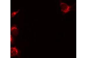 Immunofluorescence (fixed cells) (IF/ICC) image for anti-Tumor Necrosis Factor Receptor Superfamily, Member 11b (TNFRSF11B) (Internal Region) antibody (ABIN6265637)