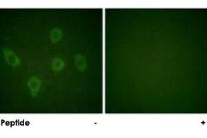 Immunofluorescence analysis of HUVEC cells, using CASP9 polyclonal antibody . (Caspase 9 Antikörper)