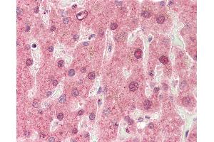 Human, Liver: Formalin-Fixed Paraffin-Embedded (FFPE). (CYP3A4 Antikörper  (AA 398-447))