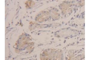 DAB staining on IHC-P; Samples: Human Stomach Tissue (HEXB Antikörper  (AA 315-456))