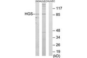 Western blot analysis of extracts from 293/HuvEc cells, using HGS Antibody. (HGS Antikörper  (AA 451-500))