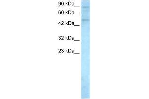 WB Suggested Anti-SMAD5 Antibody Titration:  0. (SMAD5 Antikörper  (Middle Region))