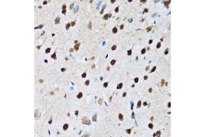 Immunohistochemistry of paraffin-embedded rat brain using CCAR2 antibody (ABIN2563550) at dilution of 1:100 (40x lens). (CCAR2 Antikörper)