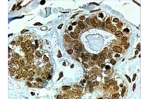 ABIN185122 (4µg/ml) staining of paraffin embedded Human Breast. (CYP7B1 Antikörper  (C-Term))
