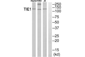 Western blot analysis of extracts from HepG2 cells, K562 cells and Jurkat cells, using TIE1 antibody. (TIE1 Antikörper  (Internal Region))