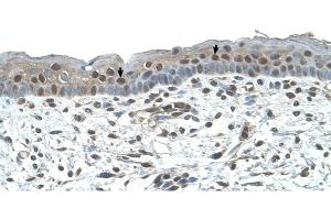 NR2C2 antibody was used for immunohistochemistry at a concentration of 4-8 ug/ml to stain Squamous epithelial cells (arrows) in Human Skin.