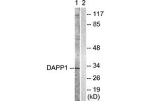 Western Blotting (WB) image for anti-Dual Adaptor of Phosphotyrosine and 3-phosphoinositides (DAPP1) (AA 105-154) antibody (ABIN2888819) (DAPP1 Antikörper  (AA 105-154))