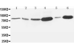 Anti-MMP9 antibody, Western blotting Lane 1: Rat Embryo Tissue Lysate Lane 2: MM453 Cell Lysate Lane 3: HELA Cell Lysate Lane 4: SMMC Cell Lysate Lane 5: JURKAT Cell Lysate Lane 6:  Cell Lysate