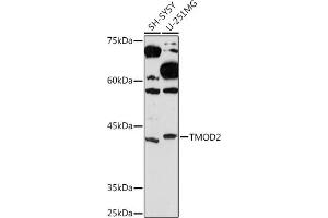 Western blot analysis of extracts of various cell lines, using TMOD2 Rabbit mAb (ABIN7271011) at 1:1000 dilution. (TMOD2 Antikörper)