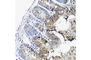 Immunohistochemistry of paraffin-embedded mouse jejunum using  antibody (ABIN6127437, ABIN6136922, ABIN6136923 and ABIN6217829) at dilution of 1:50 (40x lens). (Annexin A13 Antikörper  (AA 1-316))