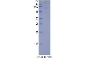 SDS-PAGE analysis of Human TERF1 Protein. (TRF1 Protein)