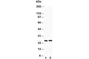 Western blot testing of Claudin 2 antibody and Lane 1:  rat kidney (Claudin 2 Antikörper  (AA 38-230))