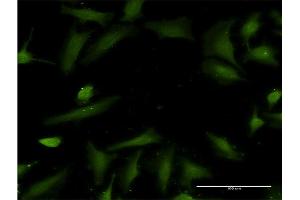 Immunofluorescence of monoclonal antibody to HTN3 on HeLa cell.