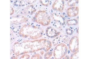 Used in DAB staining on fromalin fixed paraffin- embedded kidney tissue (MAPK13 Antikörper  (AA 1-365))