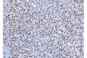 IHC analysis of SP1 using anti-SP1 antibody (ABIN7601559). (SP1 Antikörper  (AA 384-603))