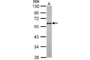 WB Image Sample (30 ug of whole cell lysate) A: A431 10% SDS PAGE antibody diluted at 1:2000 (CDC25C Antikörper)