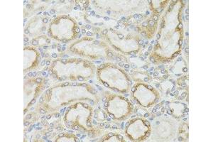 Immunohistochemistry of paraffin-embedded Rat kidney using MT-ND5 Polyclonal Antibody at dilution of 1:100 (40x lens). (MT-ND5 Antikörper)