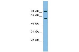ALDH7A1 antibody used at 1 ug/ml to detect target protein. (ALDH7A1 Antikörper  (N-Term))