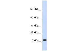 WB Suggested Anti-HMGN1 Antibody Titration:  0. (HMGN1 Antikörper  (Middle Region))