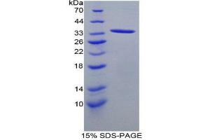 SDS-PAGE (SDS) image for Angiopoietin 4 (ANGPT4) (AA 36-297) protein (His tag) (ABIN1878945) (Angiopoietin 4 Protein (ANGPT4) (AA 36-297) (His tag))