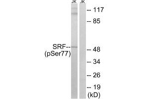 Western Blotting (WB) image for anti-Serum Response Factor (SRF) (pSer77) antibody (ABIN1847570) (SRF Antikörper  (pSer77))