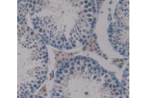 IHC-P analysis of Mouse Tissue, with DAB staining. (Dermatopontin Antikörper  (AA 29-197))