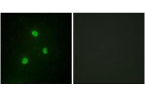 Immunofluorescence analysis of A549 cells, using TBX1 Antibody.
