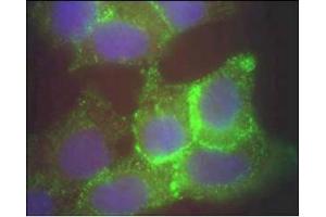 Image no. 1 for anti-Jagged 1 (JAG1) (AA 110-125) antibody (ABIN401024) (JAG1 Antikörper  (AA 110-125))