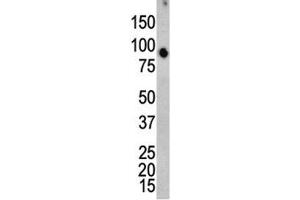 Western blot analysis of ERK4 antibody and mouse brain tissue lysate. (MAPK7 Antikörper  (AA 527-557))