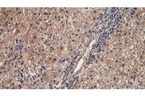 Detection of IFNg in Human Liver Tissue using Monoclonal Antibody to Interferon Gamma (IFNg) (Interferon gamma Antikörper  (AA 24-166))