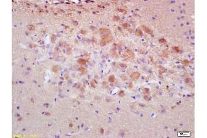 Formalin-fixed and paraffin embedded rat brain labeled with Rabbit Anti pro-caspase-3 Polyclonal Antibody, Unconjugated (ABIN747728) at 1:200 followed by conjugation to the secondary antibody and DAB staining (Caspase 3 Antikörper  (AA 11-120))
