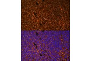 Immunofluorescence analysis of mouse embryos cells using PTCH1 antibody (ABIN1682368, ABIN1682367, ABIN3015342, ABIN3015343 and ABIN6213997) at dilution of 1:100. (Patched 1 Antikörper  (AA 1214-1312))