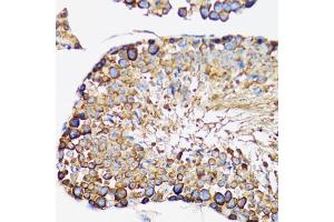 Immunohistochemistry of paraffin-embedded rat testis using IRAK4 antibody. (IRAK4 Antikörper)