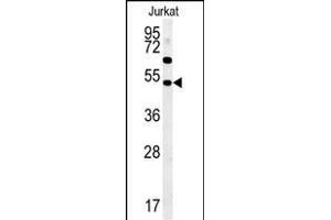 SSN1 Antibody (Center) (ABIN652058 and ABIN2840526) western blot analysis in Jurkat cell line lysates (35 μg/lane).