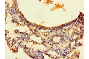 Immunohistochemistry of paraffin-embedded human lung tissue using ABIN7166376 at dilution of 1:100 (ZNF738 Antikörper  (AA 1-137))