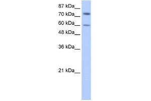 WB Suggested Anti-IGF2BP1 Antibody Titration:  0. (IGF2BP1 Antikörper  (N-Term))
